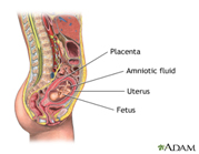 Amniocentesis