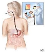 Endoscopy